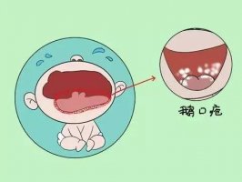 <b>ֿͻ˵¼ڴʳ ڴӦԤ</b>